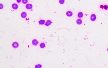 Capnocytophaga canimorsus Gram stain