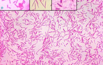 Capnocytophaga gingivalis Gram stain