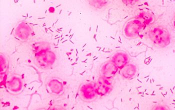 Capnocytophaga gingivalis Gram stain