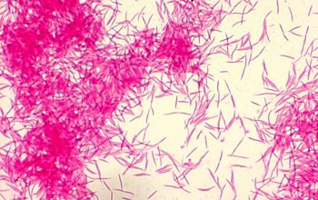 Capnocytophaga gingivalis Gram stain