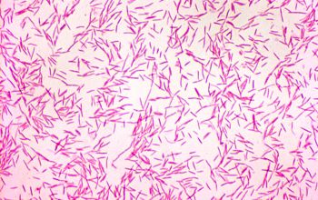 Capnocytophaga sputigena Gram stain