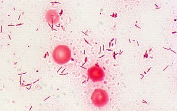 Capnocytophaga sputigena Gram stain