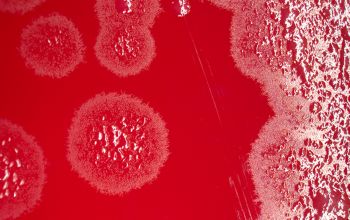 Capnocytophaga sputigena Blood Agar 24h culture incubated with CO2