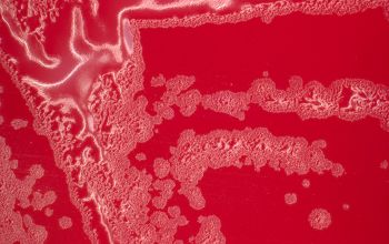 Cardiobacterium hominis Blood Agar 24h culture incubated with CO2