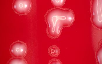 Cardiobacterium hominis Blood Agar 48h culture 