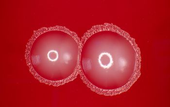 Cardiobacterium hominis Blood Agar 48h culture incubated with CO2