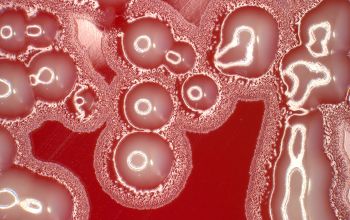 Cardiobacterium hominis  culture 