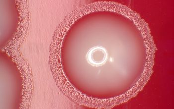 Cardiobacterium hominis  culture 