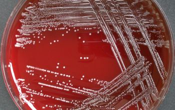 Cardiobacterium hominis  culture incubated with CO2