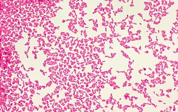 Cardiobacterium hominis Gram stain