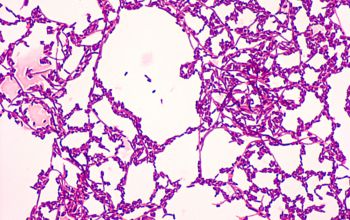 Cellulosimicrobium cellulans Gram stain