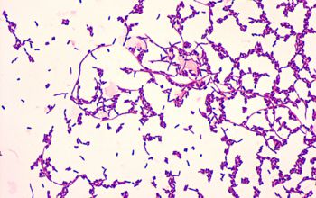 Cellulosimicrobium cellulans Gram stain