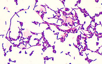 Cellulosimicrobium cellulans Gram stain