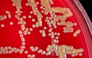 Cellulosimicrobium cellulans Blood Agar 48h culture 