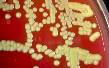 Cellulosimicrobium cellulans  culture incubated with CO2