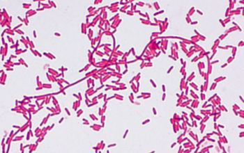 Chromobacterium violaceum Gram stain