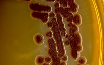 Chromobacterium violaceum Mac Conkey Agar without salt 48h culture incubated with O2