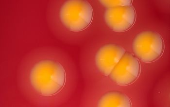 Chryseobacterium indologenes Blood Agar 24h culture incubated with CO2