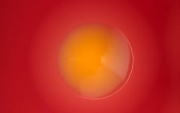 Chryseobacterium indologenes Blood Agar 24h culture incubated with CO2