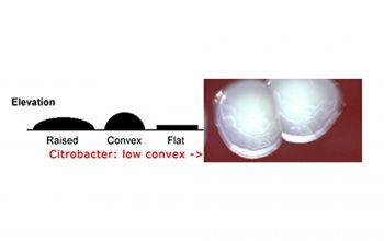 Citrobacter freundii Blood Agar 24h culture incubated with O2