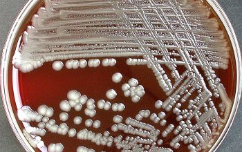 Citrobacter freundii Blood Agar 48h culture incubated with O2