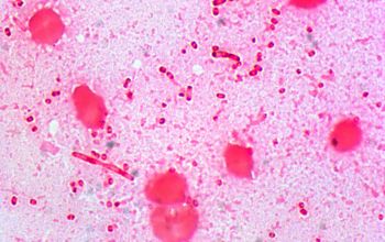 Citrobacter freundii Gram stain