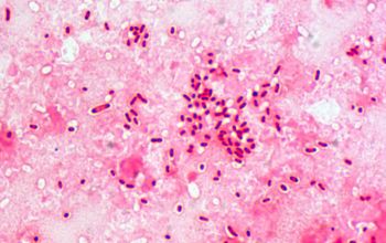 Citrobacter koseri Gram stain