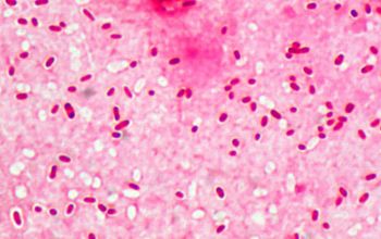Citrobacter koseri Gram stain
