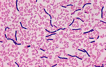 Clostridium bifermentans (Paraclostridium bifermentans) Gram stain