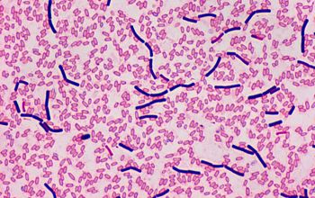 Clostridium bifermentans Gram stain