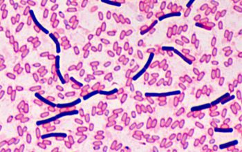 Clostridium bifermentans (Paraclostridium bifermentans) Gram stain