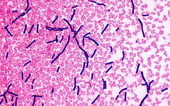 Clostridium bifermentans Gram stain