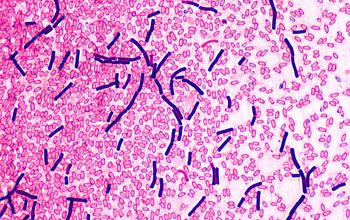 Clostridium bifermentans (Paraclostridium bifermentans) Gram stain