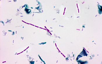 Clostridium bifermentans Wirtz stain