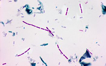 Clostridium bifermentans (Paraclostridium bifermentans) Wirtz stain