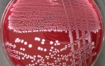 Clostridium bifermentans (Paraclostridium bifermentans) Brucella Blood Agar 48h culture anaerobicly incubated