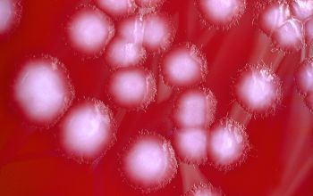 Clostridium bifermentans (Paraclostridium bifermentans) Brucella Blood Agar 48h culture 