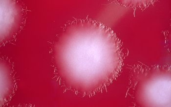 Clostridium bifermentans (Paraclostridium bifermentans) Brucella Blood Agar 48h culture anaerobicly incubated