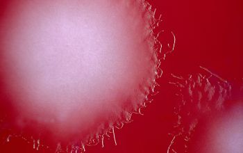 Clostridium bifermentans (Paraclostridium bifermentans) Brucella Blood Agar 48h culture anaerobicly incubated