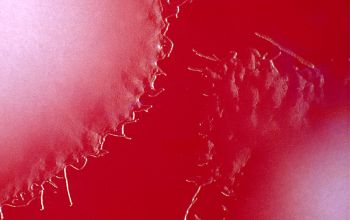 Clostridium bifermentans (Paraclostridium bifermentans) Brucella Blood Agar 48h culture anaerobicly incubated