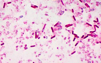 Clostridium botulinum Gram stain