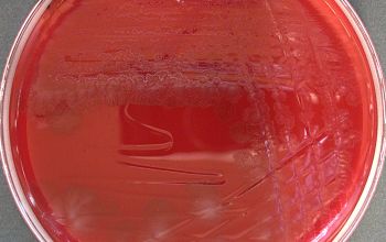 Clostridium butyricum  culture anaerobicly incubated