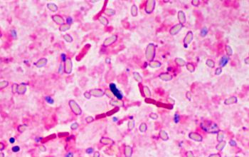 Clostridium butyricum Gram stain