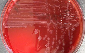 Clostridium clostridioforme (Enterocloster clostridioforme)  culture anaerobicly incubated