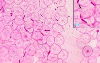 Clostridium clostridioforme (Enterocloster clostridioforme) Gram stain