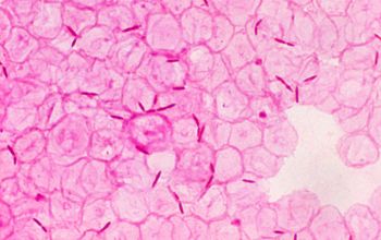 Clostridium clostridioforme (Enterocloster clostridioforme) Gram stain