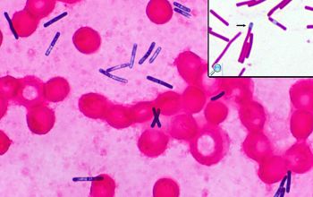 Clostridium difficile Gram stain