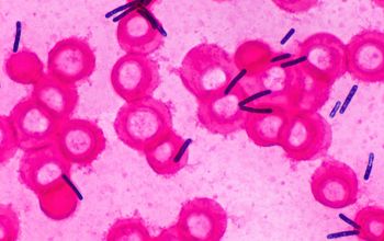 Clostridium difficile Gram stain