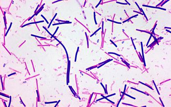 Clostridium difficile Gram stain