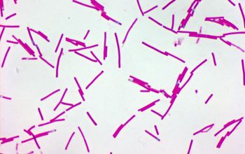 Clostridium difficile Wirtz stain